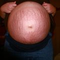 pregnant-1577212_640