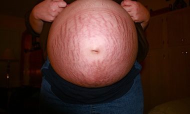 pregnant-1577212_640